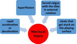 Selecting the Best Meniscal Tests 